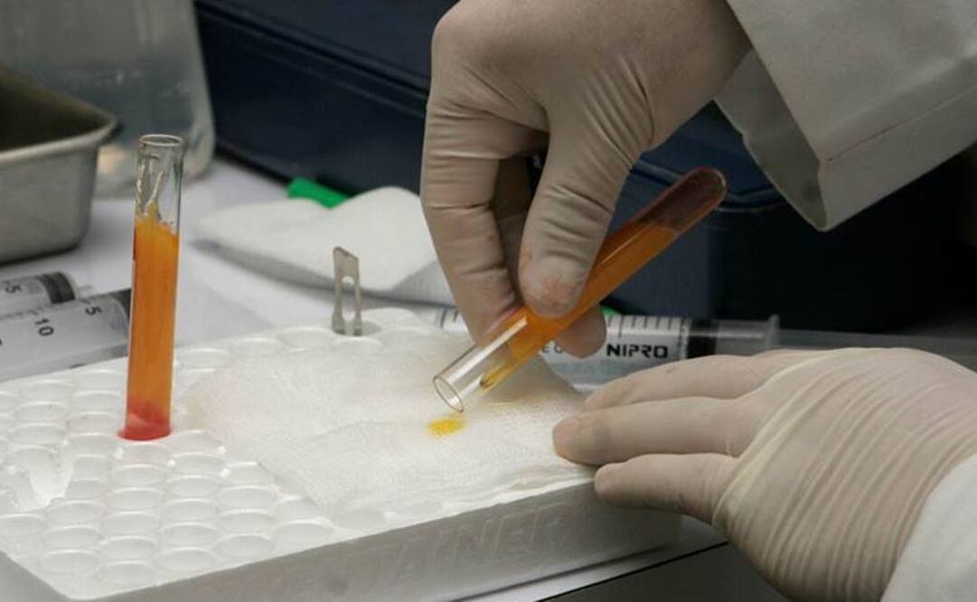 "Desde luego no hay duda de que el HDL tiene un papel protector, como también demuestra el estudio, pero ha sido exagerado". Foto: Archivo