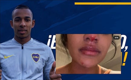 Futbolista de Boca Juniors, acusado de violencia doméstica
