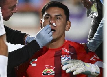 La Liga MX practicó el protocolo de conmoción y Oscar Ustari podrá jugar la vuelta contra Rayados