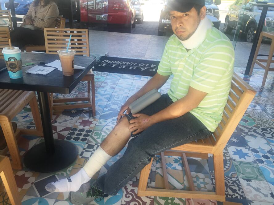 Alejandro sufrió fractura expuesta de tibia y peroné al chocar en la autopista Huitzilac-México contra la camioneta que trasladaba a José Manuel Sanz Rivera, secretario técnico del Ayuntamiento de Cuernavaca (JUSTINO MIRANDA. EL UNIVERSAL)