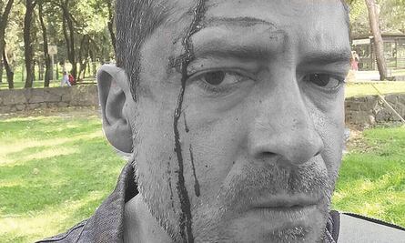 Procuraduría CDMX filtró datos de Padgett a narcos de la UNAM y solo le ofrecen terapia, denuncia el periodista