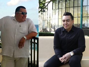 Cirugía bariátrica permite el control exitoso de la diabetes mellitus tipo 2