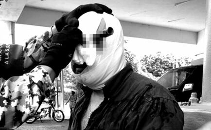 Agresor de hombre acuchillado en la cabeza podría alcanzar hasta 15 años de prisión 