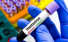 Turista da positivo a hantavirus tras viaje en Francia; fue aislado en España