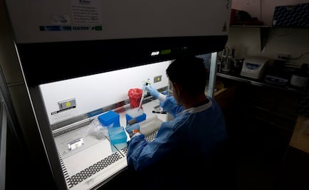 OMS: Se precisan más pruebas para confirmar vínculo entre zika y microcefalia