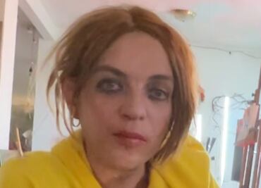 Hijo de Camilo Sesto muestra en video un año de decadencia: foto de sus piernas heridas alerta a fans