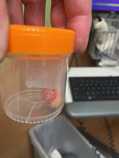 Agente del Departamento de Seguridad Nacional (DHS) pierde dedo en manifestación en Minnesota (24/01/26). Foto: @TriciaOhio