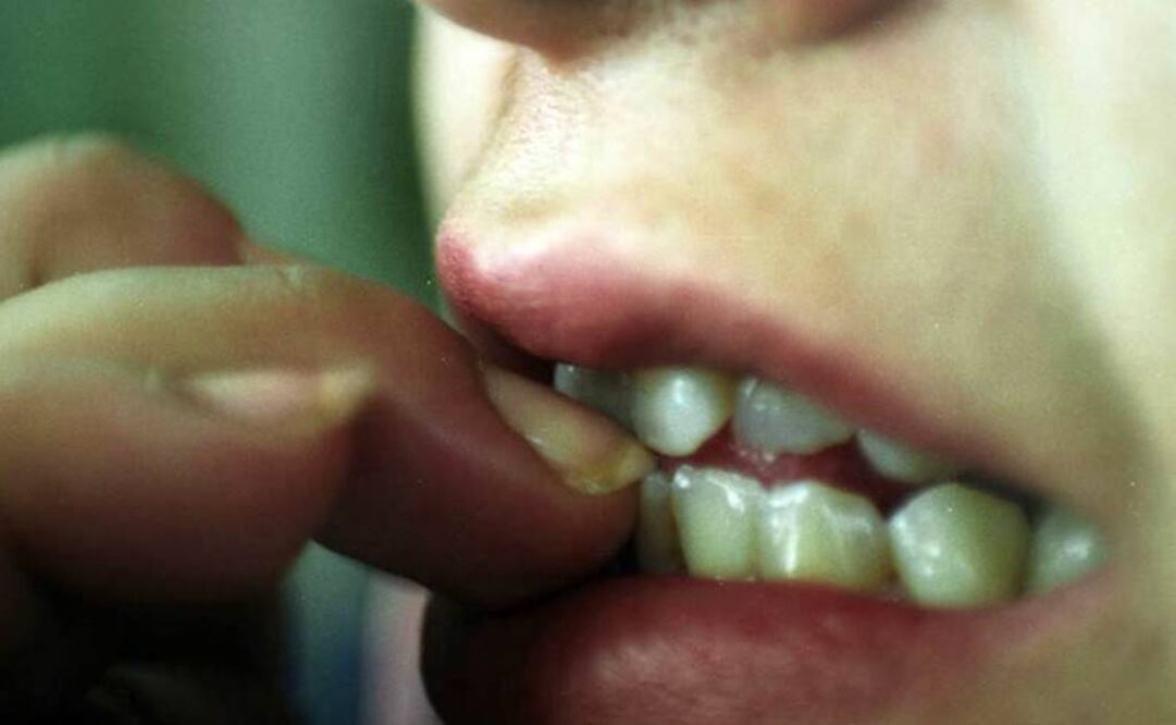 Esta práctica se califica como un trastorno obsesivo-compulsivo. Foto: Archivo