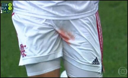 Futbolista sufre una dolorosa lesión tras pisotón en un testículo