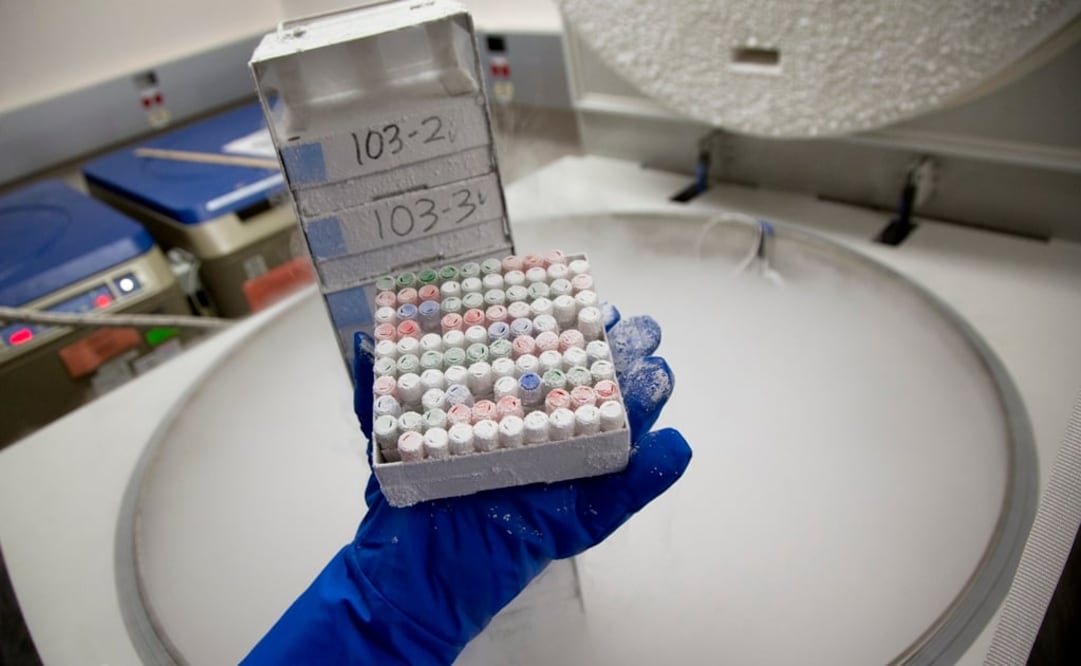 Si se cuenta con antecedentes familiares de la enfermedad es necesario recibir una asesoría genética. (FOTO: Archivo/EL UNIVERSAL)