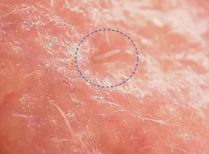 Ácaros... ¿a punto de extinguirse?, esto dice la ciencia 