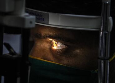 Detectan en Sinaloa a 4 pacientes Covid con Hongo Negro