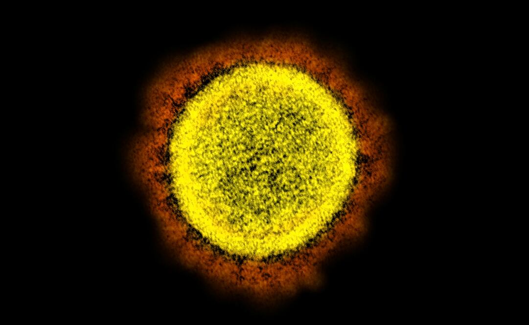 Foto: NIAID/NIH via AP, archivo