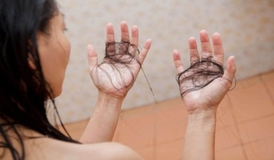 Esto podría causar que se te caiga más el pelo durante el confinamiento