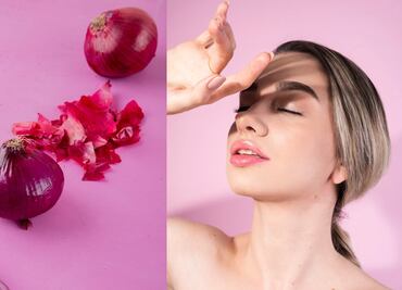 Cómo utilizar la cebolla para combatir manchas de la piel