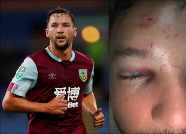 Futbolista de la Premier League recibió golpiza en Manchester