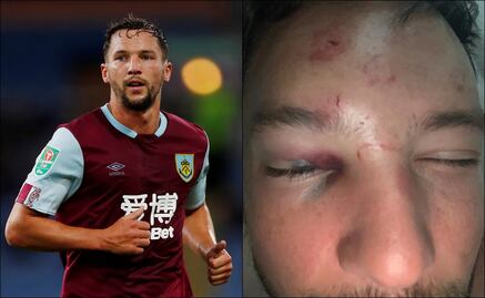 Futbolista de la Premier League recibió golpiza en Manchester