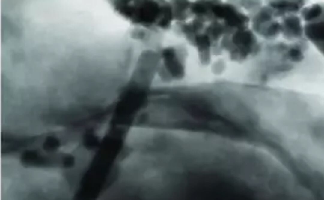 Foto: COURTNEY WAGNER, IOAN LASCU AND KENNETH LIVI vía Europa Press