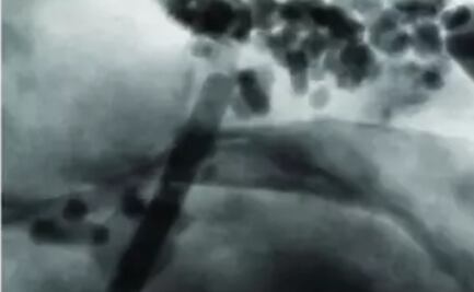 Unos fósiles magnéticos revelan pistas del clima de hace millones de años