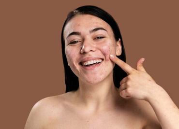 Olvídate de las manchas de la cara con este aceite que seguro tienes en tu cocina