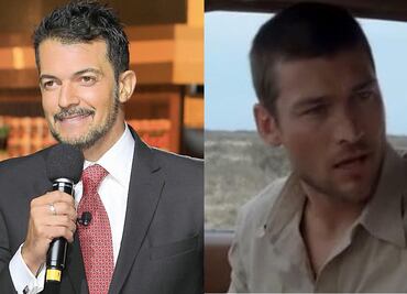 Fernando del Solar, Andy Whitfield y otros famosos que han padecido linfoma de hodgkin