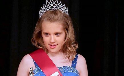 Muere niña que contrajo amiba devoradora del cerebro en EU