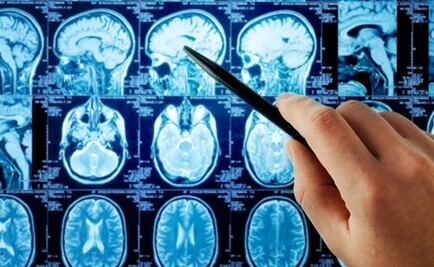 "Ameba come cerebros" mata a niño en Argentina; es el primer caso