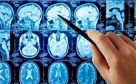 "Ameba come cerebros" mata a niño en Argentina; es el primer caso