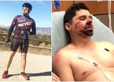 Reconstruyen mejilla de Larry Hernández tras accidente en bicicleta