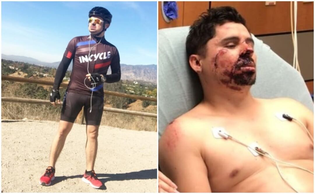 El cantante compartió fotos y video antes y después del accidente