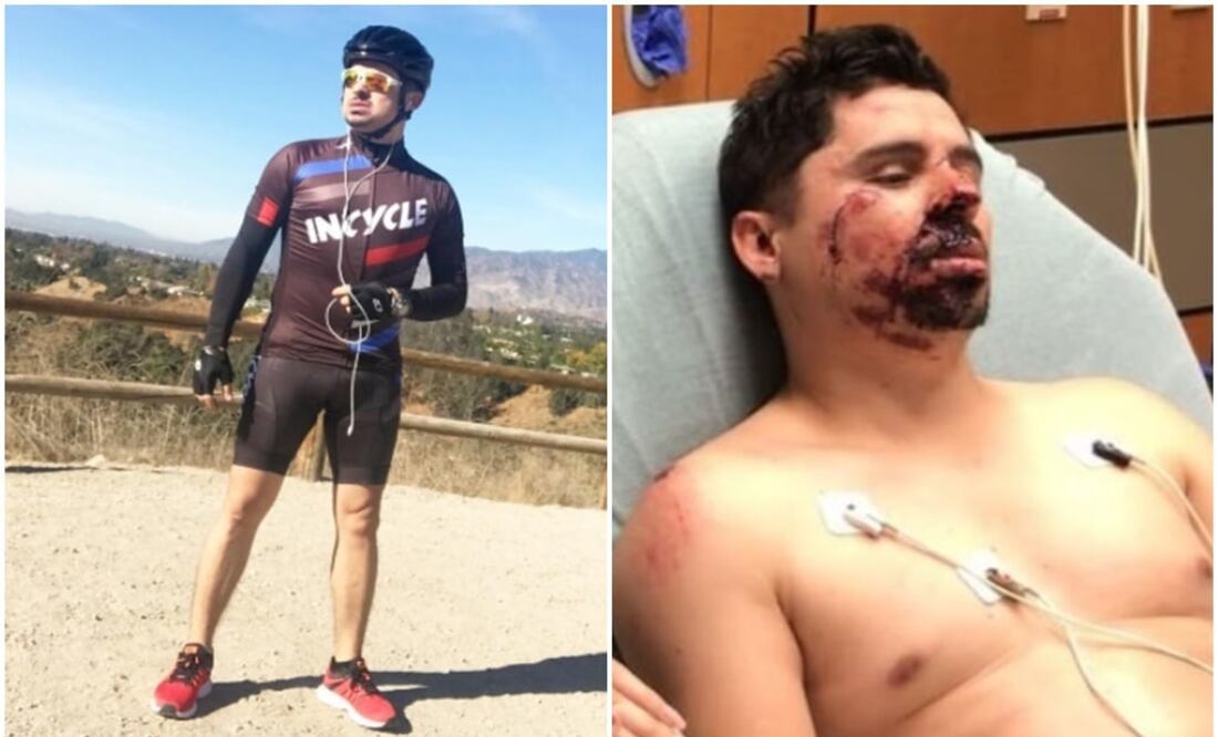 El cantante compartió fotos y video antes y después del accidente