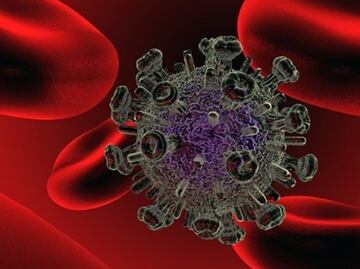 Las resonancias magnéticas ayudan a detectar el VIH en el cerebro