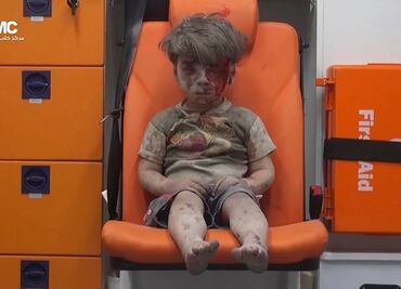 Imagen de niño herido en Aleppo se vuelve viral