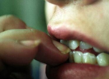 Neurosis, afecta por igual a adultos que a niños