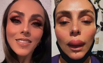 Ivonne Montero aparece con el labio inflamado en redes sociales, ¿qué le sucedió?"
