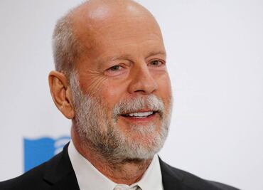 Bruce Willis: Expertos explican en qué consiste la enfermedad neurodegenerativa que padece el actor
