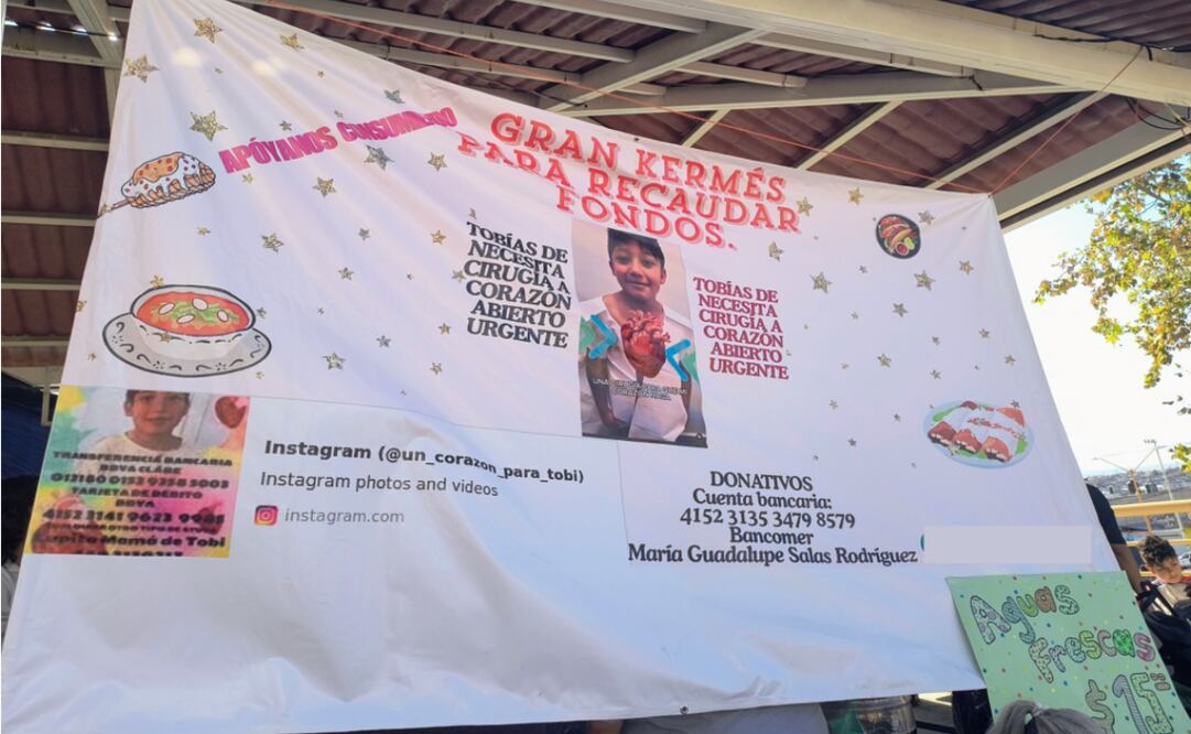 Tobías Gómez, de 8 años, busca apoyo para costear una cirugía clave para su salud. Su familia organiza eventos y rifas para recaudar fondos. FOTO: Cortesía de la familia.