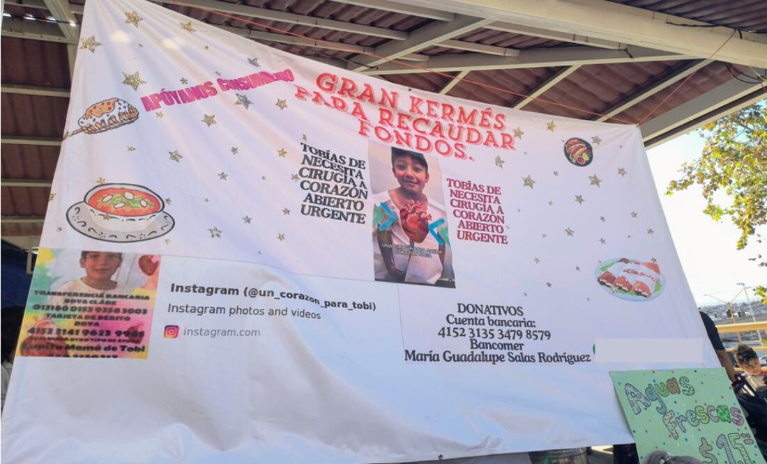 Tobías Gómez, de 8 años, busca apoyo para costear una cirugía clave para su salud. Su familia organiza eventos y rifas para recaudar fondos. FOTO: Cortesía de la familia.