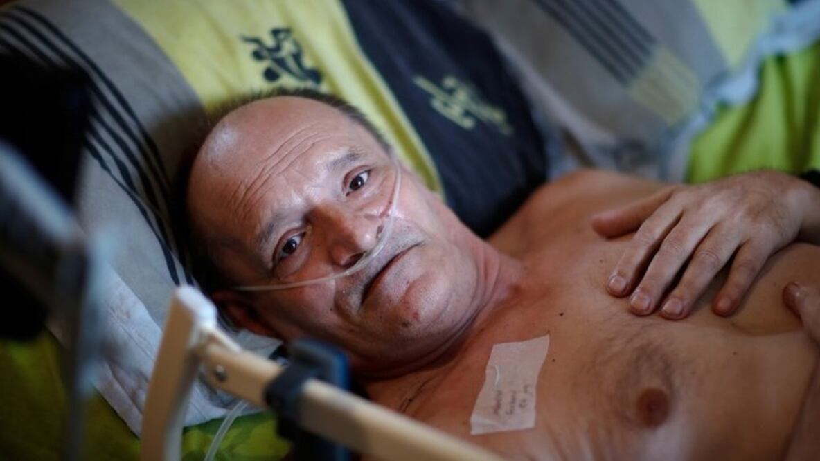 Alain Cocq, de 57 años, sufre una enfermedad rara que pega las paredes de sus arterias (Foto: Reuters)