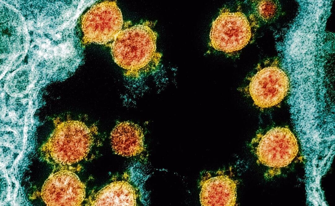 Foto: NIAID/National Institutes of Health via AP