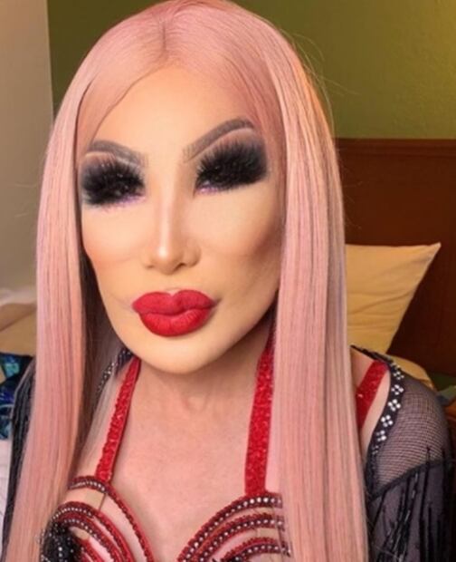 Lyn May y la metamorfosis de su rostro: en busca de la eterna belleza