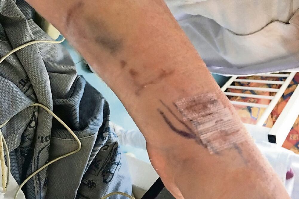 El denunciante despertó desorientado, con golpes en la cara y el cuerpo, además de una fractura en la mano izquierda. Foto: ESPECIAL