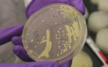 Levadura para acelerar producción de analgésicos