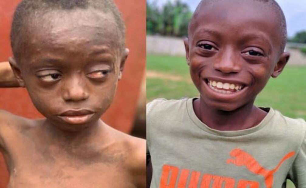 La mujer que salva a los "niños brujos" de la tortura y la muerte en África