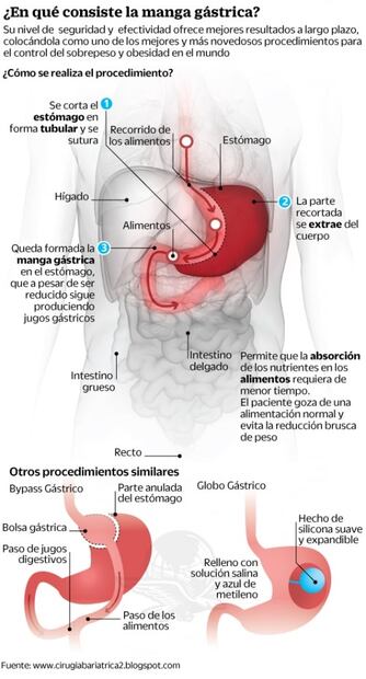 A ritmo de Queen, este doctor frena la obesidad en el quirófano