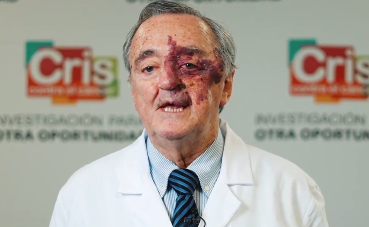 Mariano Barbacid logra curar el cáncer de páncreas en ratones; ahora busca fondos para probarlo en pacientes