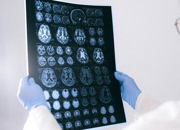 OMS advierte por brote de meningitis fúngica tras cirugías en México