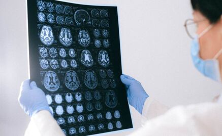 OMS advierte por brote de meningitis fúngica tras cirugías en México