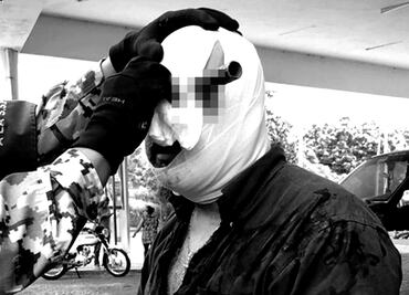 Hombre acaba con un cuchillo en la cabeza tras pelea por cajón de estacionamiento