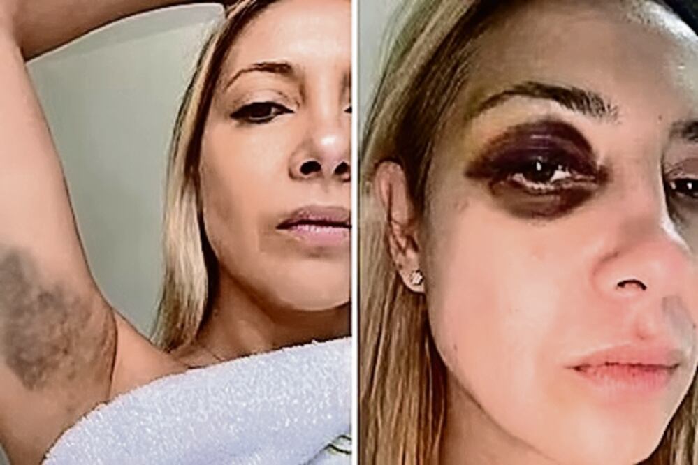 Fabiola Yáñez envió fotos de ella golpeada a Alberto Fernández cuando era la primera dama y él presidente, reprochándole su actitud violenta. Foto Especial